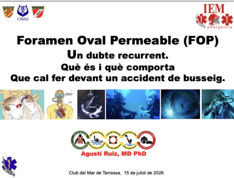 Foramen Oval Permeable: Un dubte recurrent, què és i què comporta